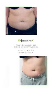 EMShapex + 2 bild Browlash Kosmetikstudio in Lachen